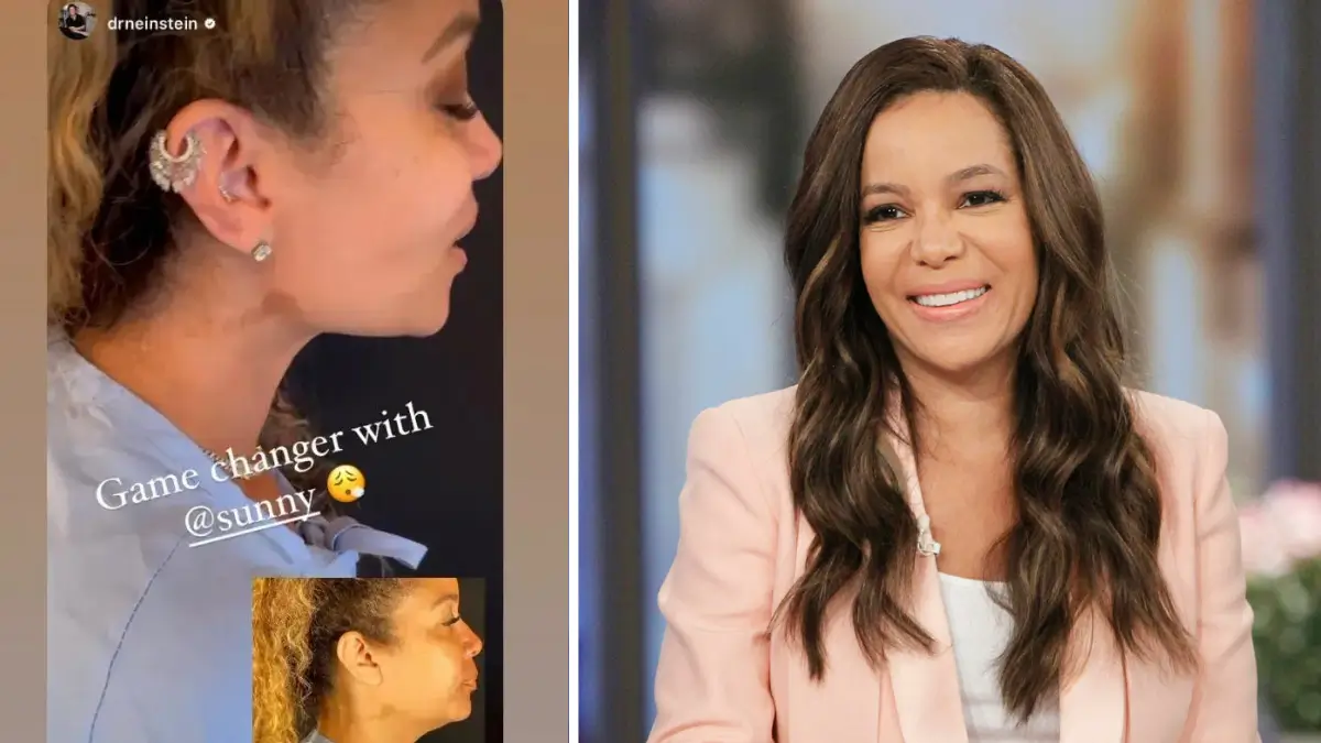 Sunny Hostin's Recent Plastic Surgery: A Look at the Before and After